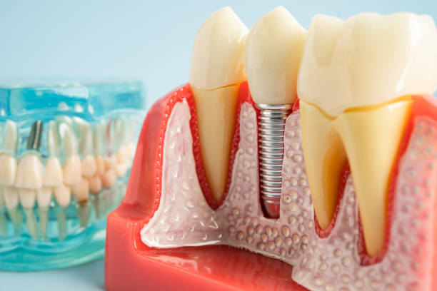 Best Periodontal (Gum) Disease Treatment  in Cross Mountain, TX